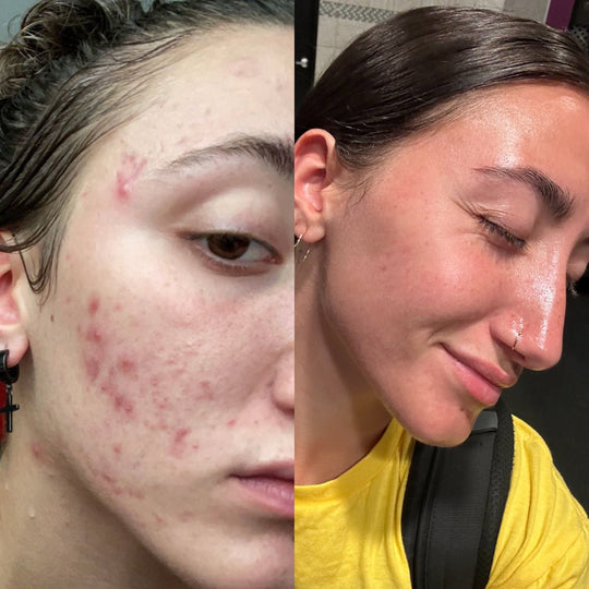 Skin Clear - Ovira