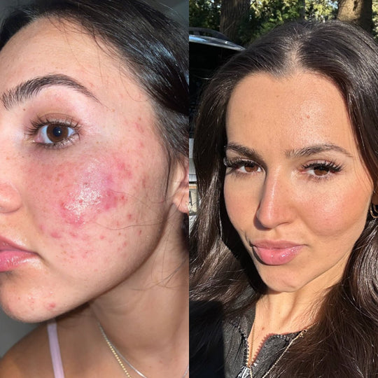 Skin Clear - Ovira